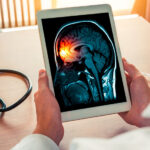 Meningite: como se prevenir dessa doença?