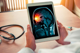 as mãos de um médico segurando um tablet, onde ele visualiza a imagem de um cérebro atingido por meningite