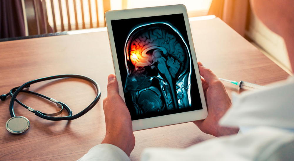 Mostra as mãos de um médico segurando um tablet, onde ele visualiza a imagem de um cérebro atingido por meningite