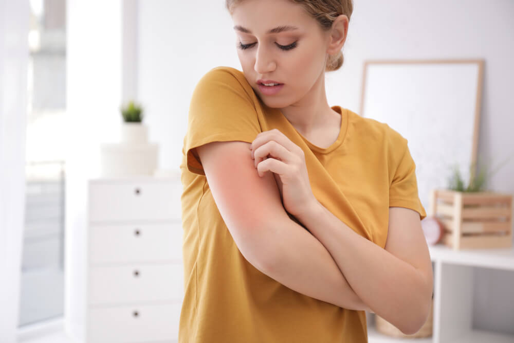 uma mulher com alergia alimentar coçando o braço que está todo vermelho