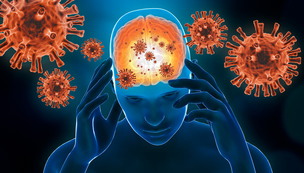 ilustração mostrando o cérebro sendo infectado por vírus. Ele serve para ilustar o post sobre meningite viral.