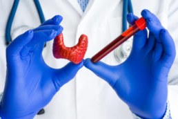 Imagem mostrando as mãos de um médico segurando um tubo com amostra de sangue e um mostruário da glândula da tireoide