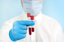 Um médico segurando dois tubos com amostra de sangue