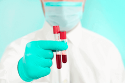 um médico de luvas verdes segurando 2 tubos de ensaio com amostras de sangue. - glicemia em jejum
