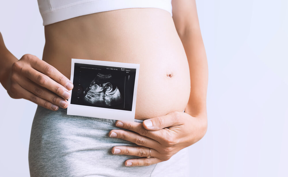 Mulher grávida segurando uma foto da ultrassonografia do feto. 