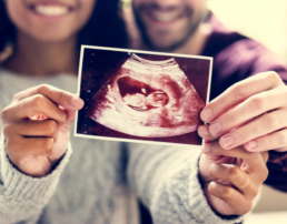 Mulher e homem seguram uma foto com a ultrassonografia de um feto de semanas, de acordo com o Calendário de Gestação.
