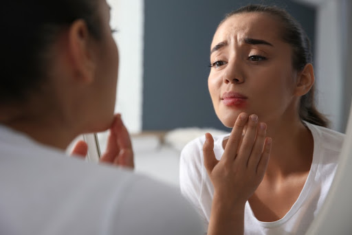 Mulher em frente ao espelho vendo se as feridas no rosto são por causa da herpes. A imagem ilustra o post o que é herpes