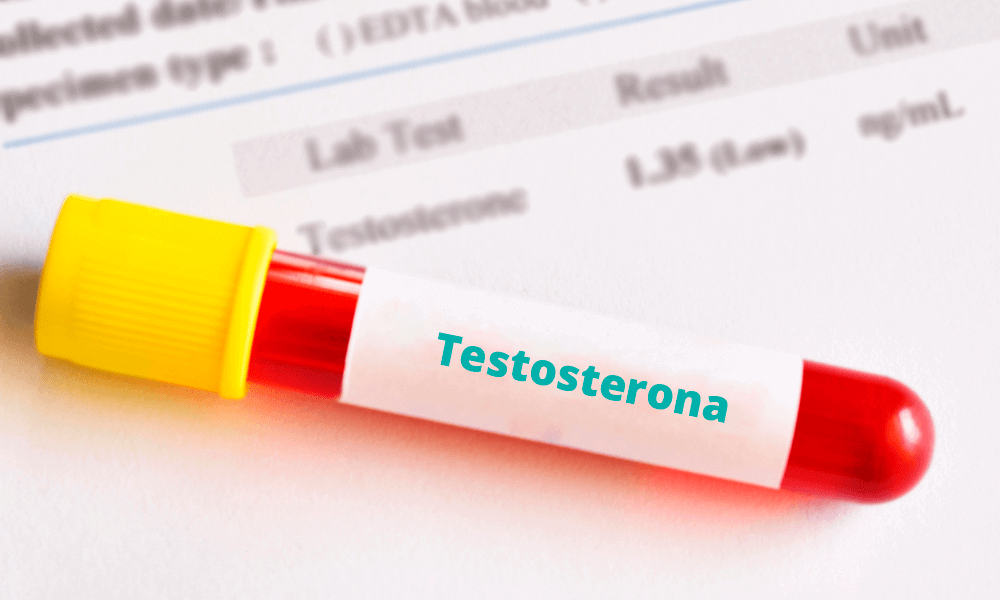Ampola de sangue para o exame de testosterona. 