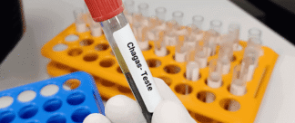 O que é doença de Chagas e como ela é transmitida?