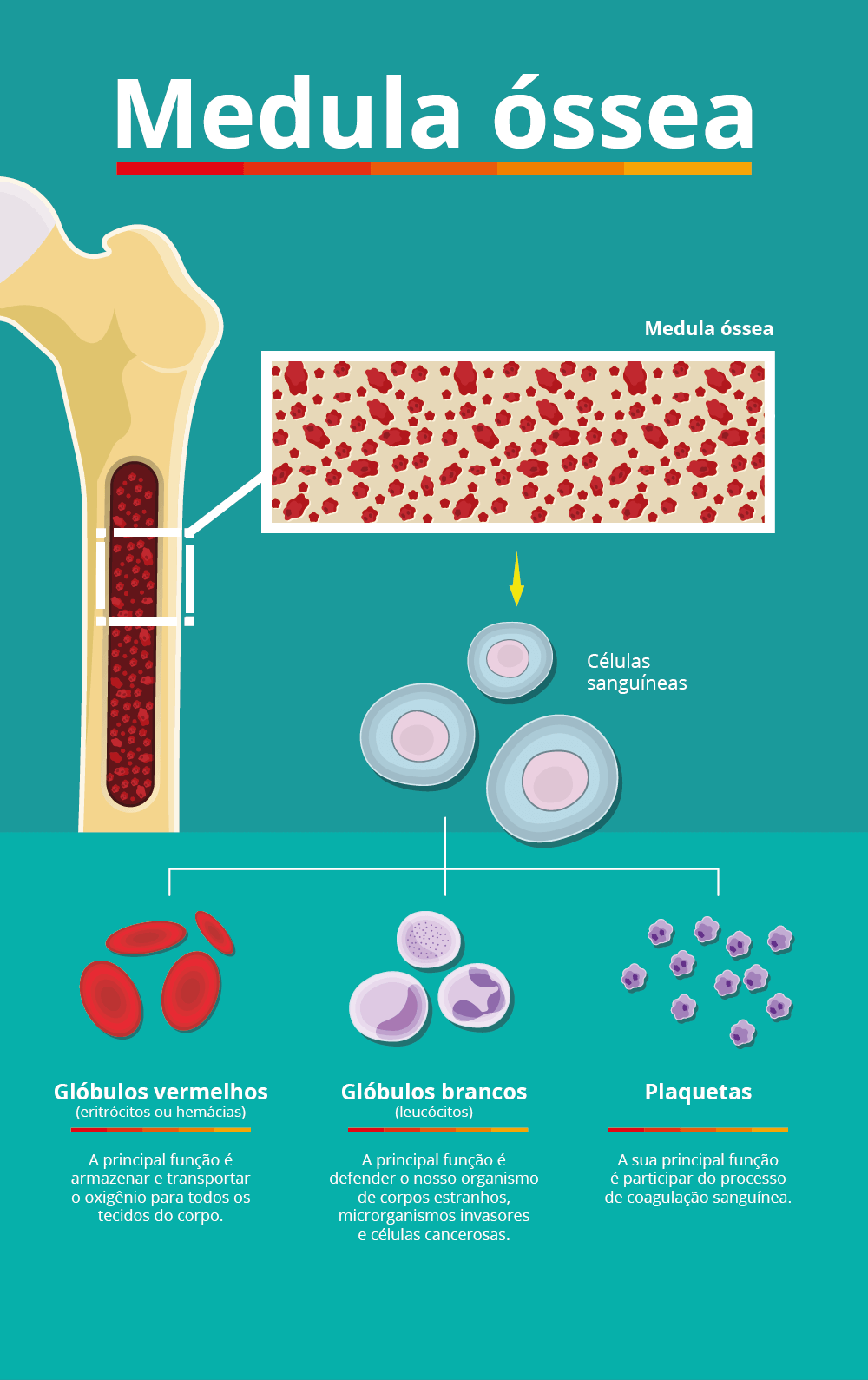 Ilustração que mostra os componentes da medula óssea, local onde ocorre o acúmulo de células brancas cancerígenas que causam a leucemia.