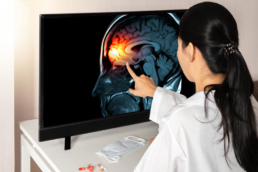 Médica aponta para uma radiografia do cérebro com infecção causada pelo surto de meningite