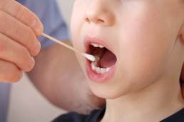 Imagem mostra uma mão segurando um cotonete e uma criança de boca aberta esperando para coleta da saliva para o teste da bochechinha