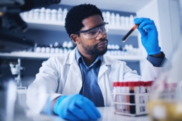 Um homem negro analisando um tubo de ensaio com sangue para exame proteina c reativa ultrassensivel